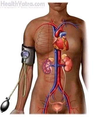 High Blood Pressure