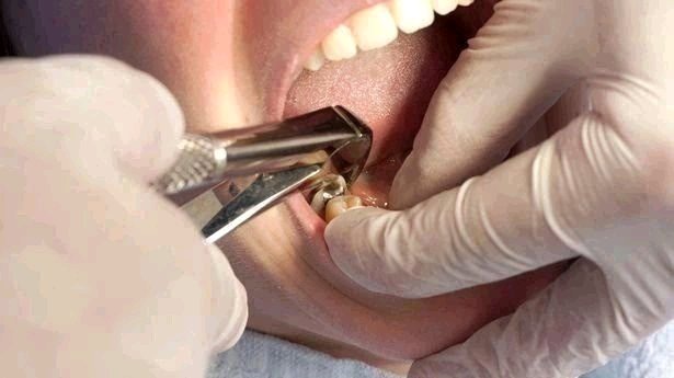 Toothache