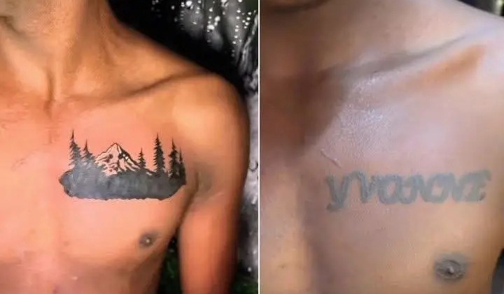 yv